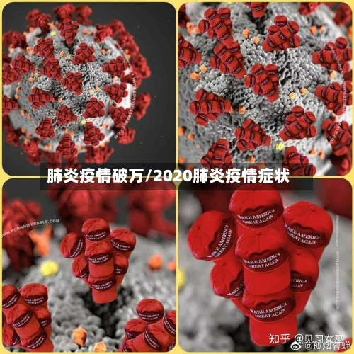 肺炎疫情破万/2020肺炎疫情症状