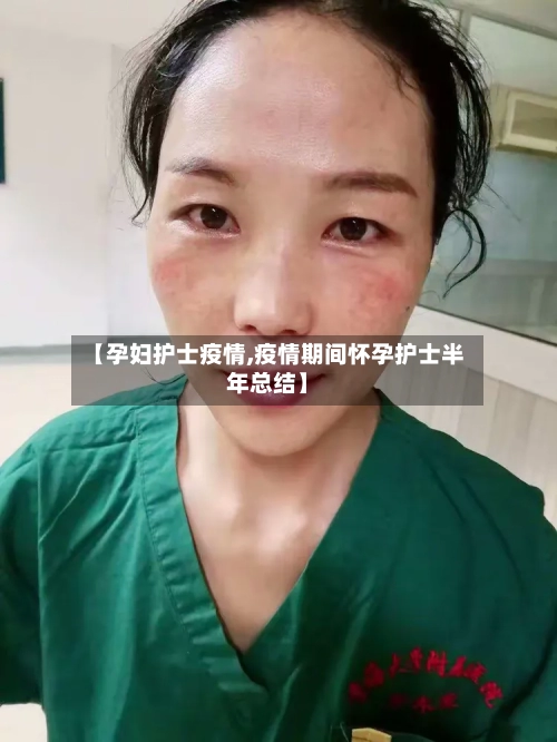 【孕妇护士疫情,疫情期间怀孕护士半年总结】